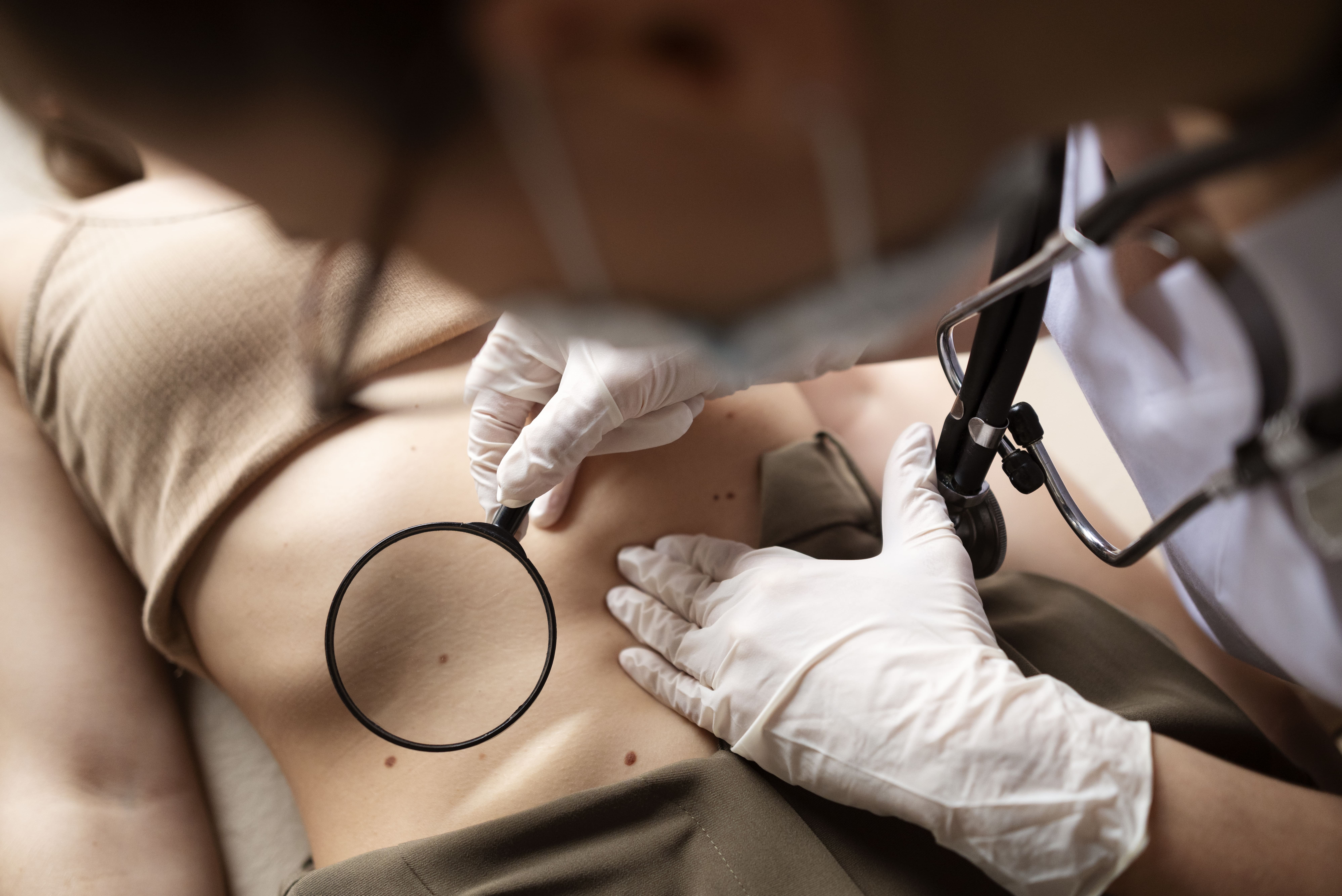 ¿Qué tratamientos son los más realizados en dermatología?